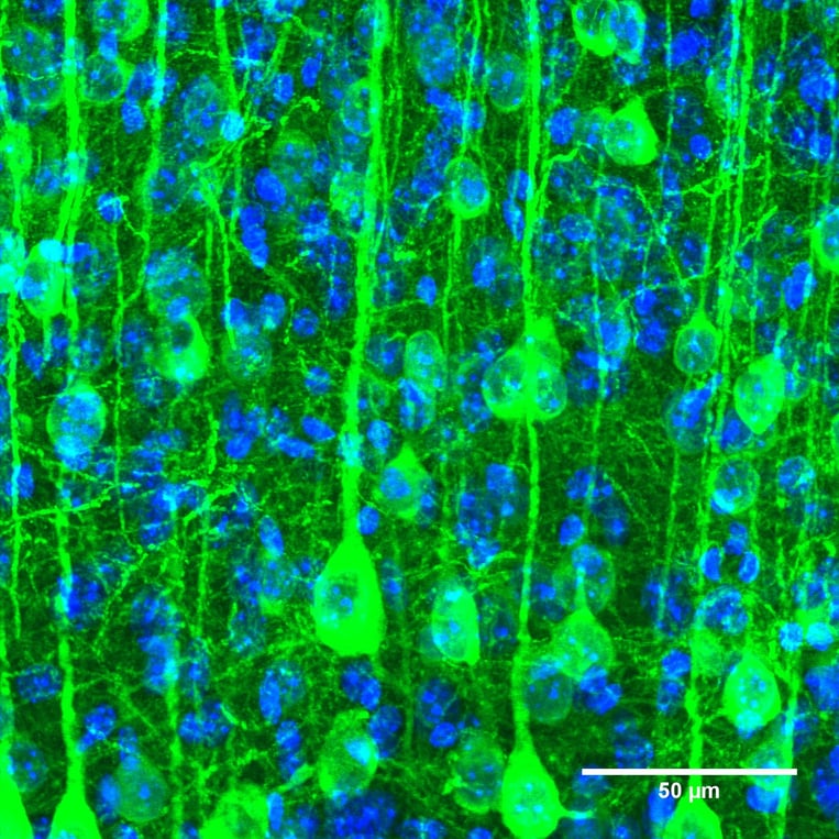 Top Five Reasons to Map Neural Circuits
